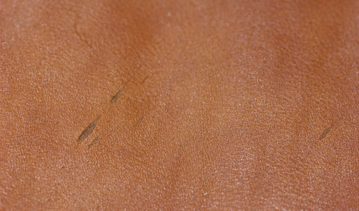 バラ傷・ピンホール